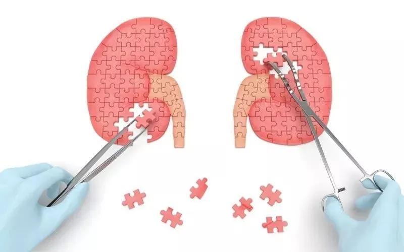 人工肾脏最新突破引领未来医疗科技革新